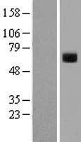 Western blot validation of overexpression lysate (Cat# LY400338) using anti-DDK antibody (Cat# TA50011-100). Left: Cell lysates from un-transfected HEK293T cells; Right: Cell lysates from HEK293T cells transfected with RC210571 using transfection reagent MegaTran 2.0 (Cat# TT210002).