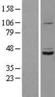 Western blot validation of overexpression lysate (Cat# LY402929) using anti-DDK antibody (Cat# TA50011-100). Left: Cell lysates from un-transfected HEK293T cells; Right: Cell lysates from HEK293T cells transfected with RC210535 using transfection reagent MegaTran 2.0 (Cat# TT210002).