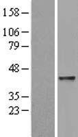 Western blot validation of overexpression lysate (Cat# LY428854) using anti-DDK antibody (Cat# TA50011-100). Left: Cell lysates from un-transfected HEK293T cells; Right: Cell lysates from HEK293T cells transfected with RC226527 using transfection reagent MegaTran 2.0 (Cat# TT210002).