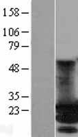 Western blot validation of overexpression lysate (Cat# LY403329) using anti-DDK antibody (Cat# TA50011-100). Left: Cell lysates from un-transfected HEK293T cells; Right: Cell lysates from HEK293T cells transfected with RC202225 using transfection reagent MegaTran 2.0 (Cat# TT210002).