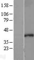 Western blot validation of overexpression lysate (Cat# LY403101) using anti-DDK antibody (Cat# TA50011-100). Left: Cell lysates from un-transfected HEK293T cells; Right: Cell lysates from HEK293T cells transfected with RC204536 using transfection reagent MegaTran 2.0 (Cat# TT210002).