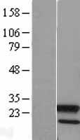 Western blot validation of overexpression lysate (Cat# LY401486) using anti-DDK antibody (Cat# TA50011-100). Left: Cell lysates from un-transfected HEK293T cells; Right: Cell lysates from HEK293T cells transfected with RC202012 using transfection reagent MegaTran 2.0 (Cat# TT210002).