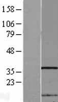 Western blot validation of overexpression lysate (Cat# LY403039) using anti-DDK antibody (Cat# TA50011-100). Left: Cell lysates from un-transfected HEK293T cells; Right: Cell lysates from HEK293T cells transfected with RC204378 using transfection reagent MegaTran 2.0 (Cat# TT210002).