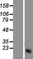 Western blot validation of overexpression lysate (Cat# LY419143) using anti-DDK antibody (Cat# TA50011-100). Left: Cell lysates from un-transfected HEK293T cells; Right: Cell lysates from HEK293T cells transfected with RC202118 using transfection reagent MegaTran 2.0 (Cat# TT210002).