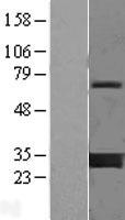 Western blot validation of overexpression lysate (Cat# LY415733) using anti-DDK antibody (Cat# TA50011-100). Left: Cell lysates from un-transfected HEK293T cells; Right: Cell lysates from HEK293T cells transfected with RC201925 using transfection reagent MegaTran 2.0 (Cat# TT210002).