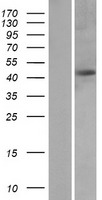 Western blot validation of overexpression lysate (Cat# LY403944) using anti-DDK antibody (Cat# TA50011-100). Left: Cell lysates from un-transfected HEK293T cells; Right: Cell lysates from HEK293T cells transfected with RC210623 using transfection reagent MegaTran 2.0 (Cat# TT210002).