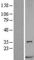 Western blot validation of overexpression lysate (Cat# LY401809) using anti-DDK antibody (Cat# TA50011-100). Left: Cell lysates from un-transfected HEK293T cells; Right: Cell lysates from HEK293T cells transfected with RC201533 using transfection reagent MegaTran 2.0 (Cat# TT210002).