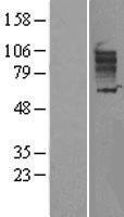 Western blot validation of overexpression lysate (Cat# LY400033) using anti-DDK antibody (Cat# TA50011-100). Left: Cell lysates from un-transfected HEK293T cells; Right: Cell lysates from HEK293T cells transfected with RC206559 using transfection reagent MegaTran 2.0 (Cat# TT210002).
