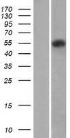 Western blot validation of overexpression lysate (Cat# LY400117) using anti-DDK antibody (Cat# TA50011-100). Left: Cell lysates from un-transfected HEK293T cells; Right: Cell lysates from HEK293T cells transfected with RC206582 using transfection reagent MegaTran 2.0 (Cat# TT210002).