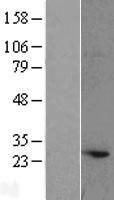 Western blot validation of overexpression lysate (Cat# LY427366) using anti-DDK antibody (Cat# TA50011-100). Left: Cell lysates from un-transfected HEK293T cells; Right: Cell lysates from HEK293T cells transfected with RC225262 using transfection reagent MegaTran 2.0 (Cat# TT210002).