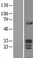 Western blot validation of overexpression lysate (Cat# LY402799) using anti-DDK antibody (Cat# TA50011-100). Left: Cell lysates from un-transfected HEK293T cells; Right: Cell lysates from HEK293T cells transfected with RC207489 using transfection reagent MegaTran 2.0 (Cat# TT210002).