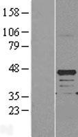 Western blot validation of overexpression lysate (Cat# LY403560) using anti-DDK antibody (Cat# TA50011-100). Left: Cell lysates from un-transfected HEK293T cells; Right: Cell lysates from HEK293T cells transfected with RC207806 using transfection reagent MegaTran 2.0 (Cat# TT210002).