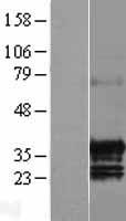 Western blot validation of overexpression lysate (Cat# LY402976) using anti-DDK antibody (Cat# TA50011-100). Left: Cell lysates from un-transfected HEK293T cells; Right: Cell lysates from HEK293T cells transfected with RC207341 using transfection reagent MegaTran 2.0 (Cat# TT210002).