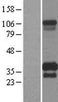 Western blot validation of overexpression lysate (Cat# LY403391) using anti-DDK antibody (Cat# TA50011-100). Left: Cell lysates from un-transfected HEK293T cells; Right: Cell lysates from HEK293T cells transfected with RC205440 using transfection reagent MegaTran 2.0 (Cat# TT210002).