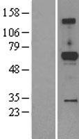 Western blot validation of overexpression lysate (Cat# LY403459) using anti-DDK antibody (Cat# TA50011-100). Left: Cell lysates from un-transfected HEK293T cells; Right: Cell lysates from HEK293T cells transfected with RC207863 using transfection reagent MegaTran 2.0 (Cat# TT210002).