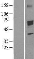 Western blot validation of overexpression lysate (Cat# LY410595) using anti-DDK antibody (Cat# TA50011-100). Left: Cell lysates from un-transfected HEK293T cells; Right: Cell lysates from HEK293T cells transfected with RC221358 using transfection reagent MegaTran 2.0 (Cat# TT210002).
