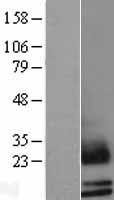 Western blot validation of overexpression lysate (Cat# LY400860) using anti-DDK antibody (Cat# TA50011-100). Left: Cell lysates from un-transfected HEK293T cells; Right: Cell lysates from HEK293T cells transfected with RC209362 using transfection reagent MegaTran 2.0 (Cat# TT210002).