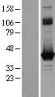 Western blot validation of overexpression lysate (Cat# LY402819) using anti-DDK antibody (Cat# TA50011-100). Left: Cell lysates from un-transfected HEK293T cells; Right: Cell lysates from HEK293T cells transfected with RC217958 using transfection reagent MegaTran 2.0 (Cat# TT210002).