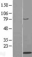 Western blot validation of overexpression lysate (Cat# LY418591) using anti-DDK antibody (Cat# TA50011-100). Left: Cell lysates from un-transfected HEK293T cells; Right: Cell lysates from HEK293T cells transfected with RC223781 using transfection reagent MegaTran 2.0 (Cat# TT210002).