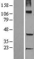 Western blot validation of overexpression lysate (Cat# LY402255) using anti-DDK antibody (Cat# TA50011-100). Left: Cell lysates from un-transfected HEK293T cells; Right: Cell lysates from HEK293T cells transfected with RC224738 using transfection reagent MegaTran 2.0 (Cat# TT210002).