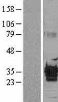 Western blot validation of overexpression lysate (Cat# LY403381) using anti-DDK antibody (Cat# TA50011-100). Left: Cell lysates from un-transfected HEK293T cells; Right: Cell lysates from HEK293T cells transfected with RC212873 using transfection reagent MegaTran 2.0 (Cat# TT210002).