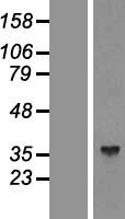 Western blot validation of overexpression lysate (Cat# LY417475) using anti-DDK antibody (Cat# TA50011-100). Left: Cell lysates from un-transfected HEK293T cells; Right: Cell lysates from HEK293T cells transfected with RC200333 using transfection reagent MegaTran 2.0 (Cat# TT210002).
