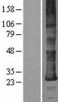 Western blot validation of overexpression lysate (Cat# LY402491) using anti-DDK antibody (Cat# TA50011-100). Left: Cell lysates from un-transfected HEK293T cells; Right: Cell lysates from HEK293T cells transfected with RC203046 using transfection reagent MegaTran 2.0 (Cat# TT210002).