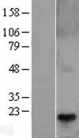 Western blot validation of overexpression lysate (Cat# LY401215) using anti-DDK antibody (Cat# TA50011-100). Left: Cell lysates from un-transfected HEK293T cells; Right: Cell lysates from HEK293T cells transfected with RC203158 using transfection reagent MegaTran 2.0 (Cat# TT210002).