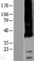 Western blot validation of overexpression lysate (Cat# LY402487) using anti-DDK antibody (Cat# TA50011-100). Left: Cell lysates from un-transfected HEK293T cells; Right: Cell lysates from HEK293T cells transfected with RC203645 using transfection reagent MegaTran 2.0 (Cat# TT210002).
