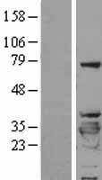 Western blot validation of overexpression lysate (Cat# LY403387) using anti-DDK antibody (Cat# TA50011-100). Left: Cell lysates from un-transfected HEK293T cells; Right: Cell lysates from HEK293T cells transfected with RC200402 using transfection reagent MegaTran 2.0 (Cat# TT210002).