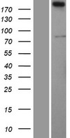 Western blot validation of overexpression lysate (Cat# LY402249) using anti-DDK antibody (Cat# TA50011-100). Left: Cell lysates from un-transfected HEK293T cells; Right: Cell lysates from HEK293T cells transfected with RC204122 using transfection reagent MegaTran 2.0 (Cat# TT210002).