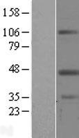 Western blot validation of overexpression lysate (Cat# LY401512) using anti-DDK antibody (Cat# TA50011-100). Left: Cell lysates from un-transfected HEK293T cells; Right: Cell lysates from HEK293T cells transfected with RC204327 using transfection reagent MegaTran 2.0 (Cat# TT210002).