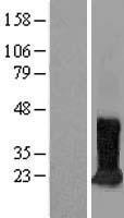 Western blot validation of overexpression lysate (Cat# LY416733) using anti-DDK antibody (Cat# TA50011-100). Left: Cell lysates from un-transfected HEK293T cells; Right: Cell lysates from HEK293T cells transfected with RC200281 using transfection reagent MegaTran 2.0 (Cat# TT210002).