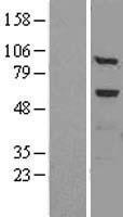 Western blot validation of overexpression lysate (Cat# LY424897) using anti-DDK antibody (Cat# TA50011-100). Left: Cell lysates from un-transfected HEK293T cells; Right: Cell lysates from HEK293T cells transfected with RC205683 using transfection reagent MegaTran 2.0 (Cat# TT210002).