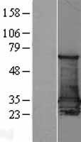 Western blot validation of overexpression lysate (Cat# LY401850) using anti-DDK antibody (Cat# TA50011-100). Left: Cell lysates from un-transfected HEK293T cells; Right: Cell lysates from HEK293T cells transfected with RC204045 using transfection reagent MegaTran 2.0 (Cat# TT210002).