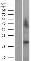 Western blot validation of overexpression lysate (Cat# LY401824) using anti-DDK antibody (Cat# TA50011-100). Left: Cell lysates from un-transfected HEK293T cells; Right: Cell lysates from HEK293T cells transfected with RC204863 using transfection reagent MegaTran 2.0 (Cat# TT210002).