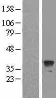 Western blot validation of overexpression lysate (Cat# LY411559) using anti-DDK antibody (Cat# TA50011-100). Left: Cell lysates from un-transfected HEK293T cells; Right: Cell lysates from HEK293T cells transfected with RC203453 using transfection reagent MegaTran 2.0 (Cat# TT210002).