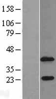 Western blot validation of overexpression lysate (Cat# LY402752) using anti-DDK antibody (Cat# TA50011-100). Left: Cell lysates from un-transfected HEK293T cells; Right: Cell lysates from HEK293T cells transfected with RC205826 using transfection reagent MegaTran 2.0 (Cat# TT210002).