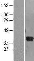Western blot validation of overexpression lysate (Cat# LY417892) using anti-DDK antibody (Cat# TA50011-100). Left: Cell lysates from un-transfected HEK293T cells; Right: Cell lysates from HEK293T cells transfected with RC204975 using transfection reagent MegaTran 2.0 (Cat# TT210002).