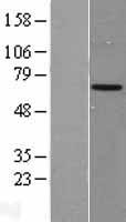 Western blot validation of overexpression lysate (Cat# LY401310) using anti-DDK antibody (Cat# TA50011-100). Left: Cell lysates from un-transfected HEK293T cells; Right: Cell lysates from HEK293T cells transfected with RC205058 using transfection reagent MegaTran 2.0 (Cat# TT210002).