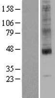 Western blot validation of overexpression lysate (Cat# LY401931) using anti-DDK antibody (Cat# TA50011-100). Left: Cell lysates from un-transfected HEK293T cells; Right: Cell lysates from HEK293T cells transfected with RC204670 using transfection reagent MegaTran 2.0 (Cat# TT210002).