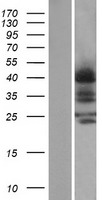 Western blot validation of overexpression lysate (Cat# LY401687) using anti-DDK antibody (Cat# TA50011-100). Left: Cell lysates from un-transfected HEK293T cells; Right: Cell lysates from HEK293T cells transfected with RC210003 using transfection reagent MegaTran 2.0 (Cat# TT210002).