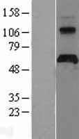 Western blot validation of overexpression lysate (Cat# LY403498) using anti-DDK antibody (Cat# TA50011-100). Left: Cell lysates from un-transfected HEK293T cells; Right: Cell lysates from HEK293T cells transfected with RC208639 using transfection reagent MegaTran 2.0 (Cat# TT210002).
