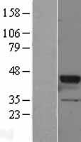 Western blot validation of overexpression lysate (Cat# LY401620) using anti-DDK antibody (Cat# TA50011-100). Left: Cell lysates from un-transfected HEK293T cells; Right: Cell lysates from HEK293T cells transfected with RC200685 using transfection reagent MegaTran 2.0 (Cat# TT210002).