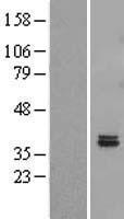 Western blot validation of overexpression lysate (Cat# LY404307) using anti-DDK antibody (Cat# TA50011-100). Left: Cell lysates from un-transfected HEK293T cells; Right: Cell lysates from HEK293T cells transfected with RC209152 using transfection reagent MegaTran 2.0 (Cat# TT210002).