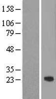 Western blot validation of overexpression lysate (Cat# LY413253) using anti-DDK antibody (Cat# TA50011-100). Left: Cell lysates from un-transfected HEK293T cells; Right: Cell lysates from HEK293T cells transfected with RC206114 using transfection reagent MegaTran 2.0 (Cat# TT210002).