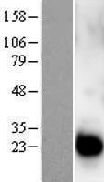 Western blot validation of overexpression lysate (Cat# LY401316) using anti-DDK antibody (Cat# TA50011-100). Left: Cell lysates from un-transfected HEK293T cells; Right: Cell lysates from HEK293T cells transfected with RC206285 using transfection reagent MegaTran 2.0 (Cat# TT210002).