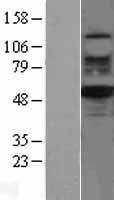 Western blot validation of overexpression lysate (Cat# LY401993) using anti-DDK antibody (Cat# TA50011-100). Left: Cell lysates from un-transfected HEK293T cells; Right: Cell lysates from HEK293T cells transfected with RC200933 using transfection reagent MegaTran 2.0 (Cat# TT210002).