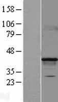 Western blot validation of overexpression lysate (Cat# LY403196) using anti-DDK antibody (Cat# TA50011-100). Left: Cell lysates from un-transfected HEK293T cells; Right: Cell lysates from HEK293T cells transfected with RC203550 using transfection reagent MegaTran 2.0 (Cat# TT210002).