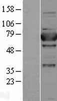 Western blot validation of overexpression lysate (Cat# LY402779) using anti-DDK antibody (Cat# TA50011-100). Left: Cell lysates from un-transfected HEK293T cells; Right: Cell lysates from HEK293T cells transfected with RC203535 using transfection reagent MegaTran 2.0 (Cat# TT210002).